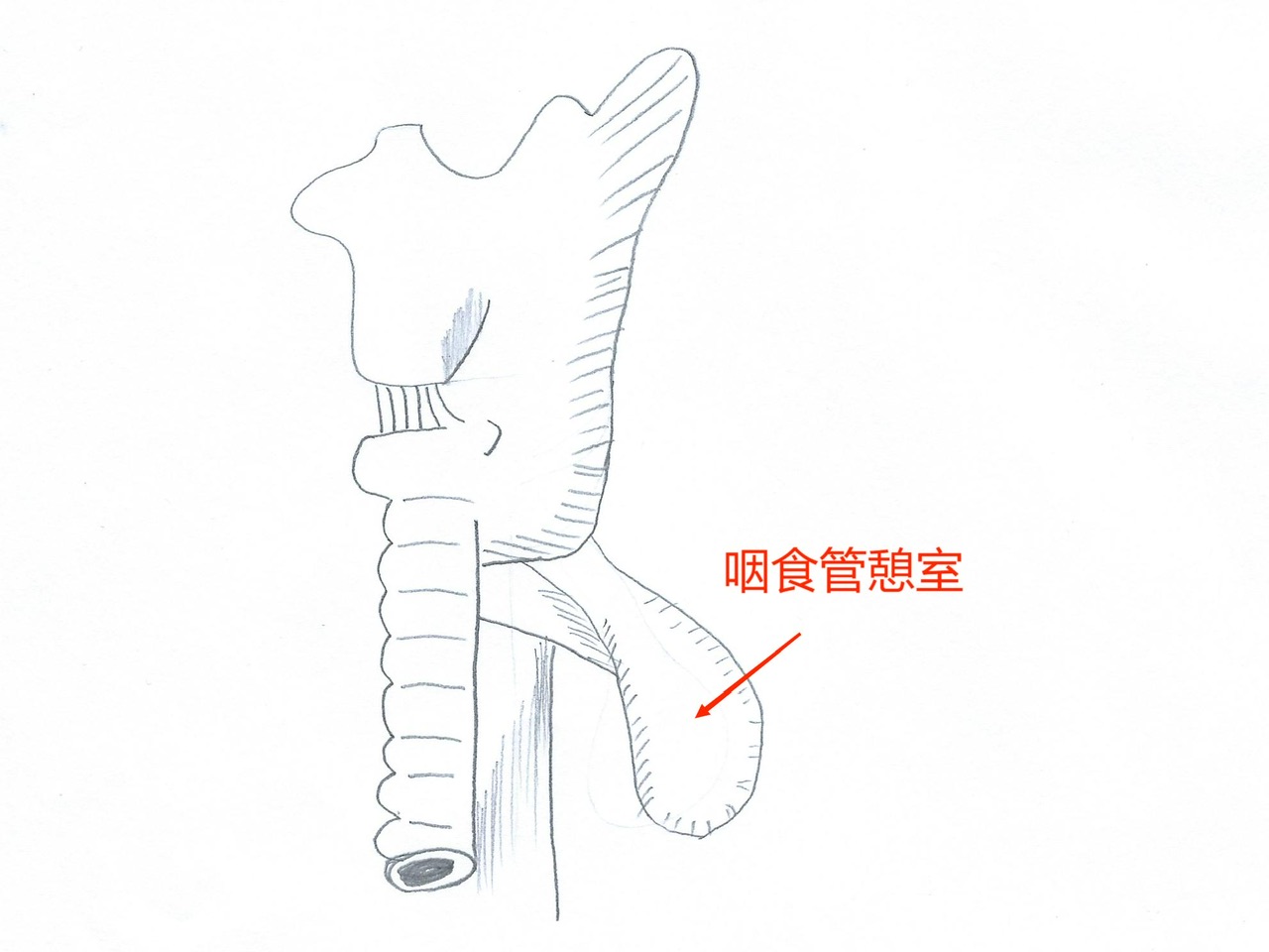 Zhongshan Hospital collaborates with multiple disciplines to reshape the patient's "life channel". The elderly in their seventies have difficulty eating for six months and have lost 30 pounds due to severe weight loss. The diverticulum | esophagus | discipline