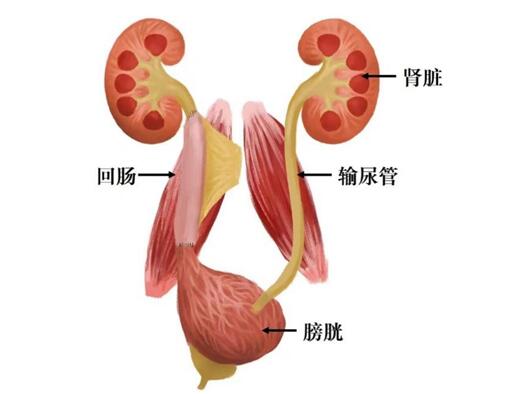 How to transform the intestine into the ureter? Da Vinci Surgical Robot Assists "Graft" Bracelet | Ureter | Robot