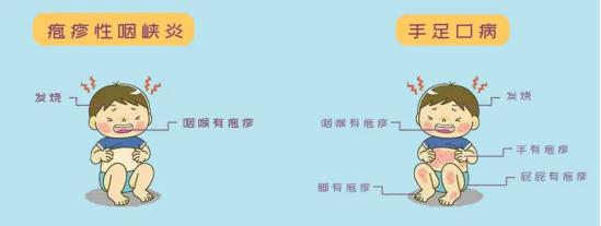 Hospital: Recently, there has been a high incidence of herpes, with a high fever of 40 ℃! It can be contagious! Many parents are holding their children and urgently sending them for medical treatment | Herpes | Parents