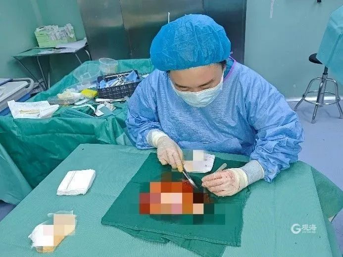 The surgery lasted for nearly 15 hours... and the entire scalp was torn off, it hurts to think about it! A woman's long hair accidentally gets tangled in a kart wheel. Her long hair | scalp | whole face